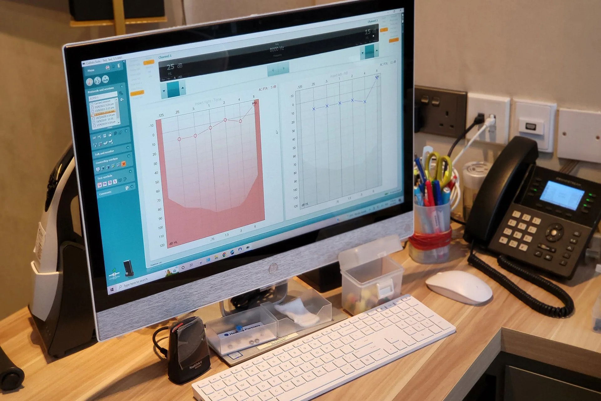audiologist tinnitus treatment