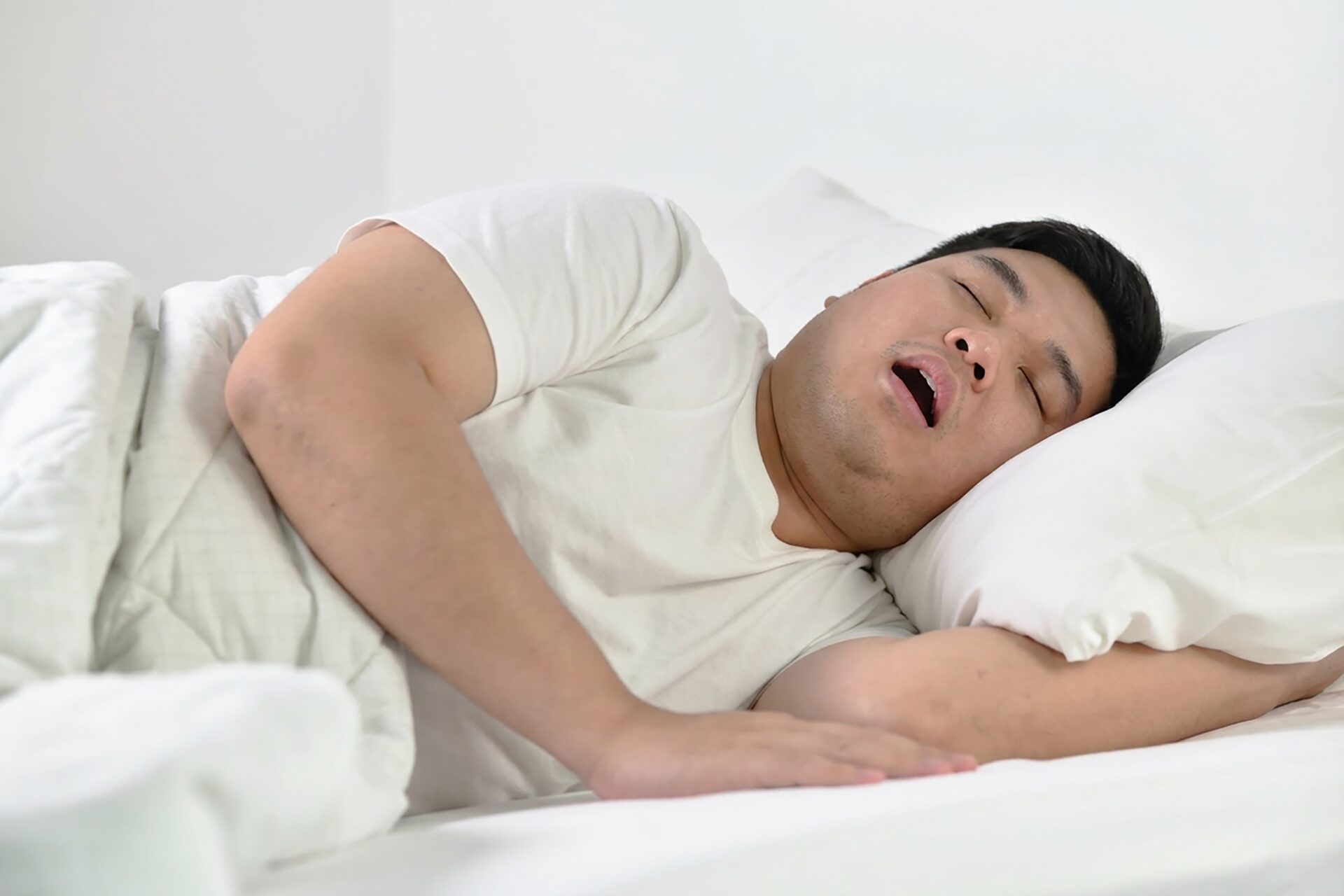 obstructive sleep apnea causes